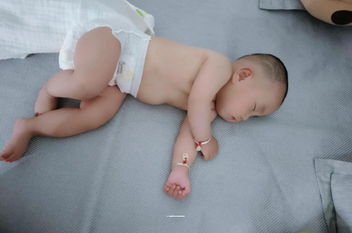 湛江六个月宝宝眼睛散光